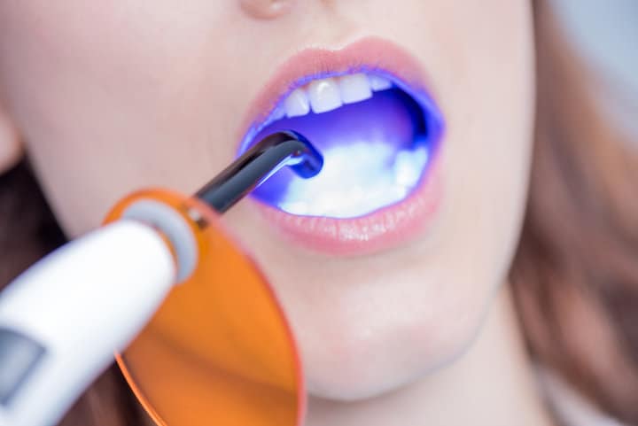 curing black light dentist